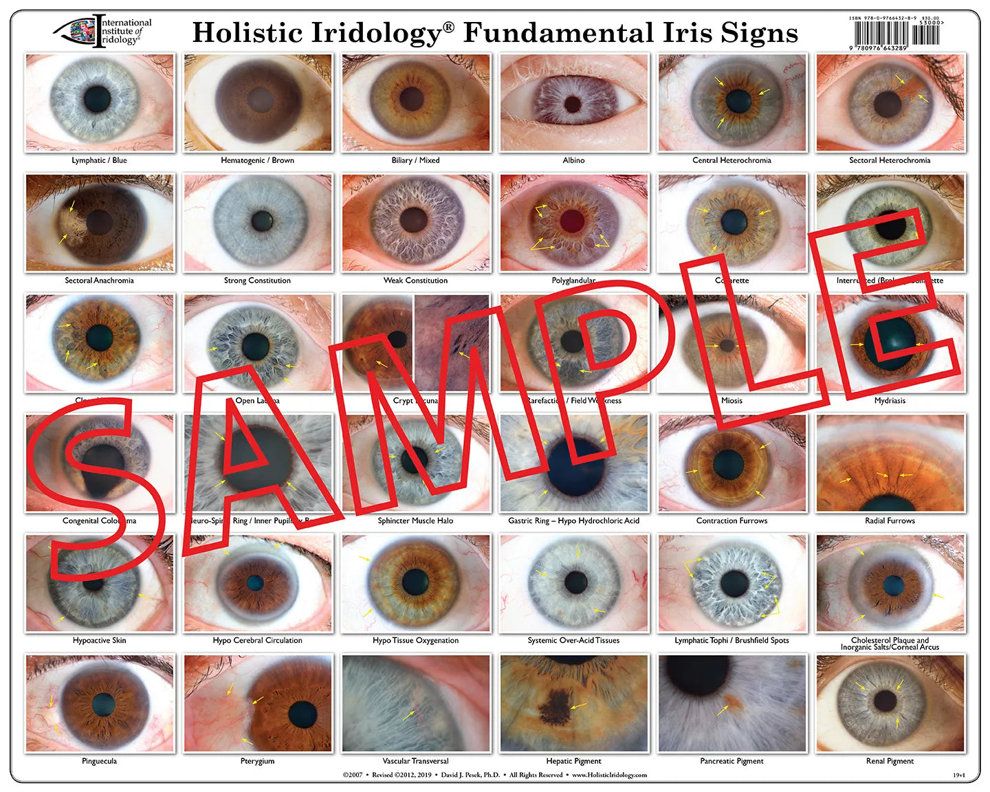Fundamental Iris Signs Poster Chart