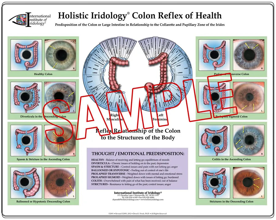 Colon Reflex of Health Poster Chart