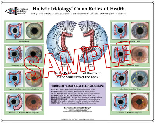 Colon Reflex of Health Poster Chart