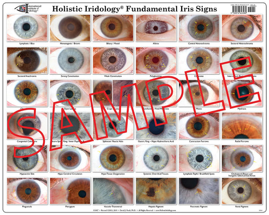 Fundamental Iris Signs Poster Chart